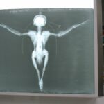Radiografía del esmerejón con un ala fracturada